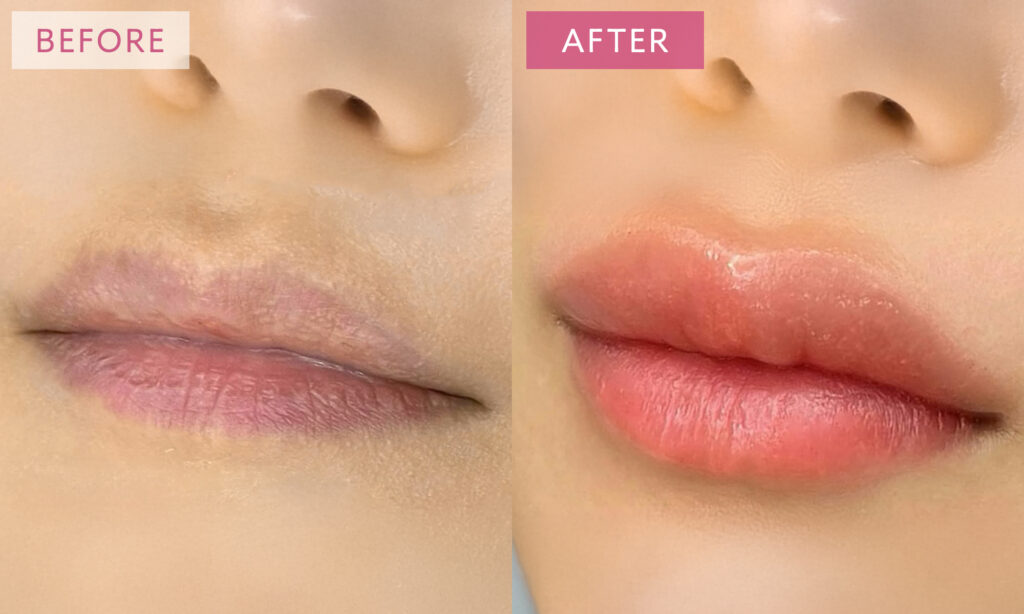 リップアートメイク症例写真