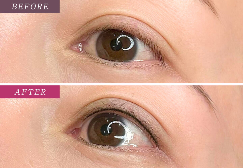 アイラインアートメイクの症例写真