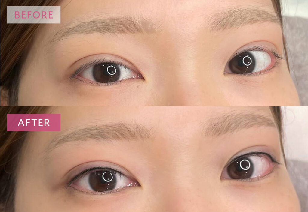 アイラインアートメイクの症例