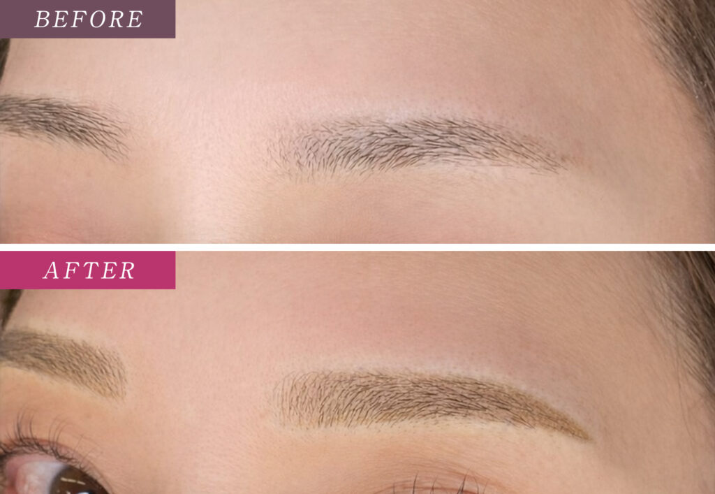 眉毛アートメイクの症例写真