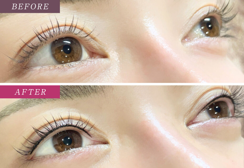 アイラインアートメイクの症例写真