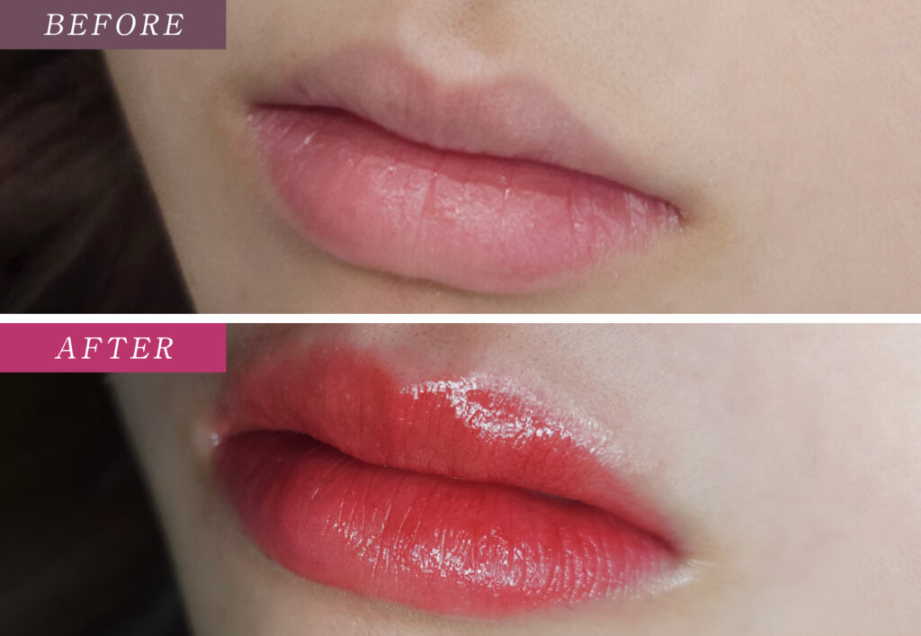 リップアートメイクの症例写真