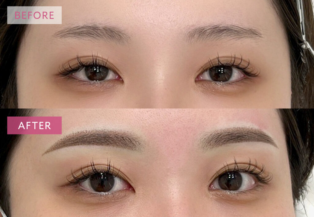 眉アートメイク症例写真