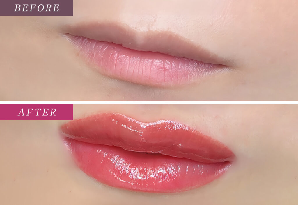 リップアートメイク症例