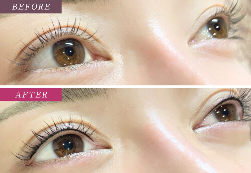 アイラインアートメイク症例