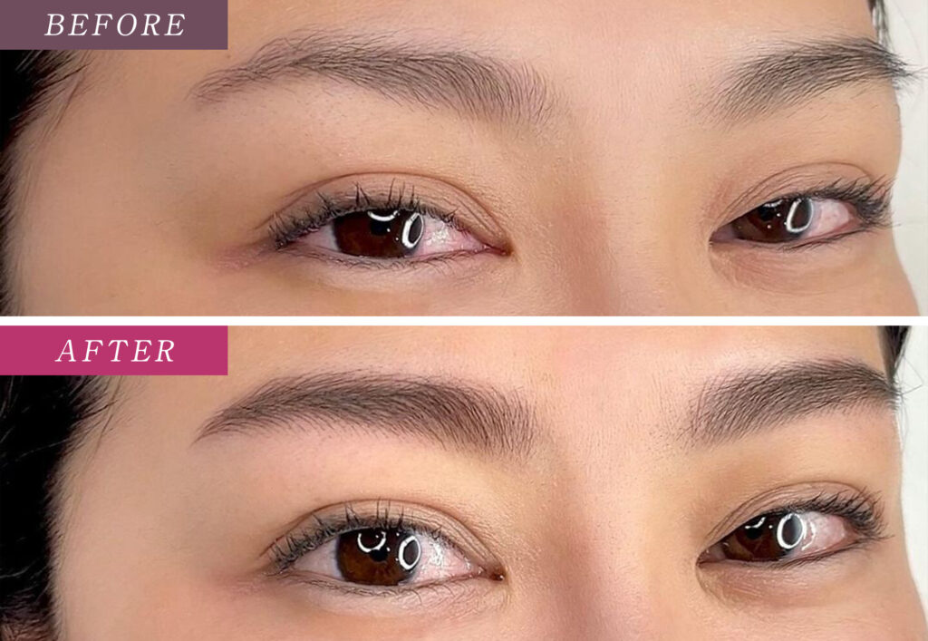 眉毛アートメイク症例写真