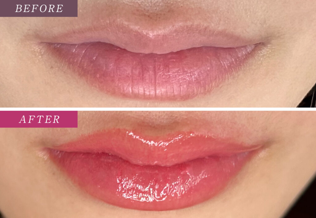 リップアートメイク症例写真