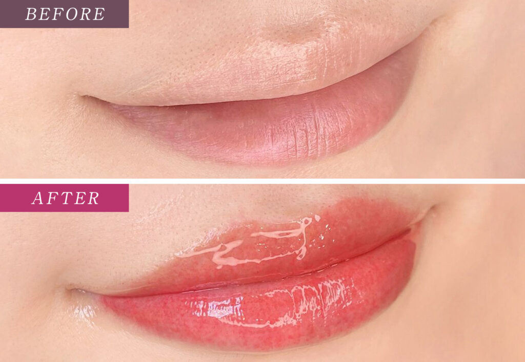 リップアートメイク症例写真